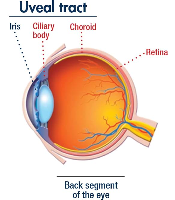 Uveal tract